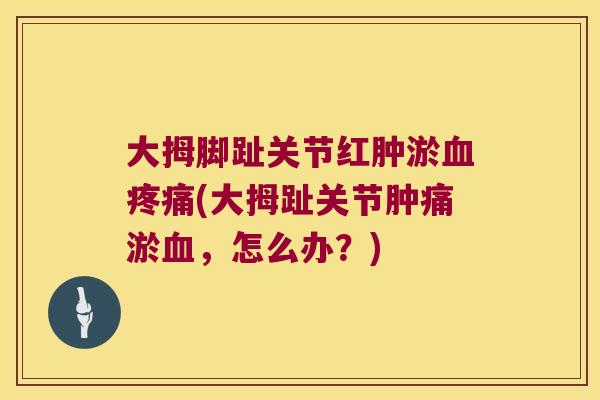 大拇脚趾关节红肿淤血疼痛(大拇趾关节肿痛淤血,怎么办?)