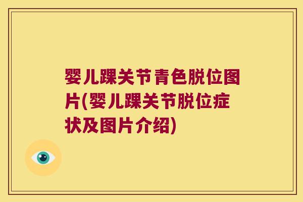 婴儿踝关节青色脱位图片(婴儿踝关节脱位症状及图片介绍)