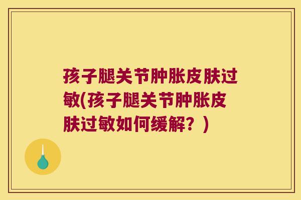 孩子腿关节肿胀皮肤过敏(孩子腿关节肿胀皮肤过敏如何缓解？)