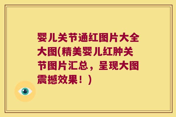 婴儿关节通红图片大全大图(精美婴儿红肿关节图片汇总,呈现大图震撼效果!)