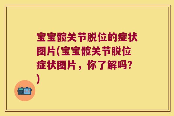 宝宝髋关节脱位的症状图片(宝宝髋关节脱位症状图片,你了解吗?) 宝宝髋关节脱位的症状图片(宝宝髋关节脱位症状图片,你了解吗?)