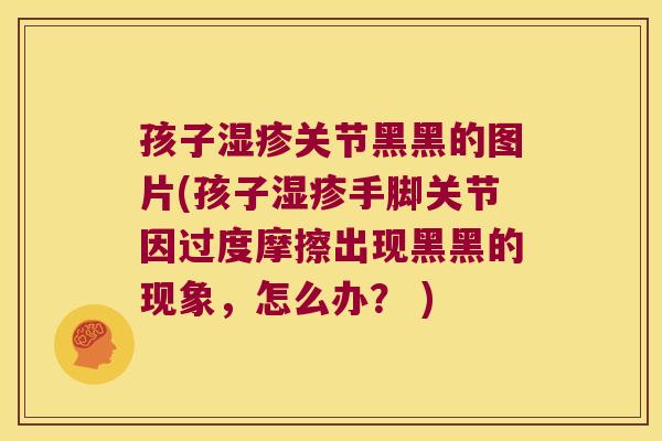 孩子湿疹关节黑黑的图片(孩子湿疹手脚关节因过度摩擦出现黑黑的现象,怎么办? )