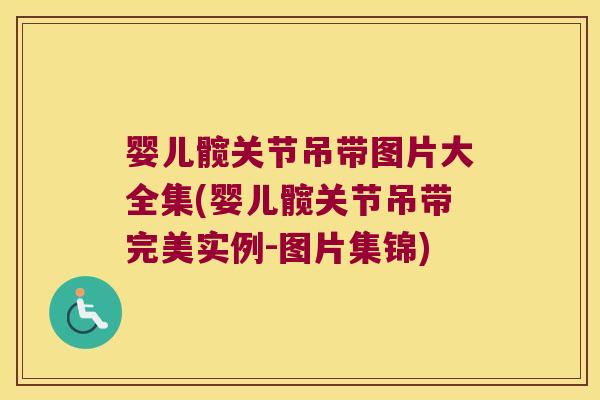 婴儿髋关节吊带图片大全集(婴儿髋关节吊带完美实例-图片集锦)