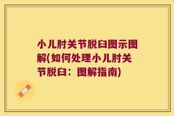 小儿肘关节脱臼图示图解(如何处理小儿肘关节脱臼:图解指南) 小儿肘关节脱臼图示图解(如何处理小儿肘关节脱臼:图解指南)