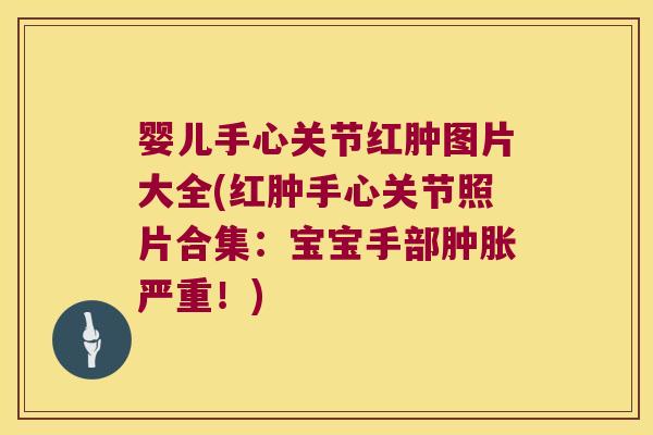 婴儿手心关节红肿图片大全(红肿手心关节照片合集:宝宝手部肿胀严重!)