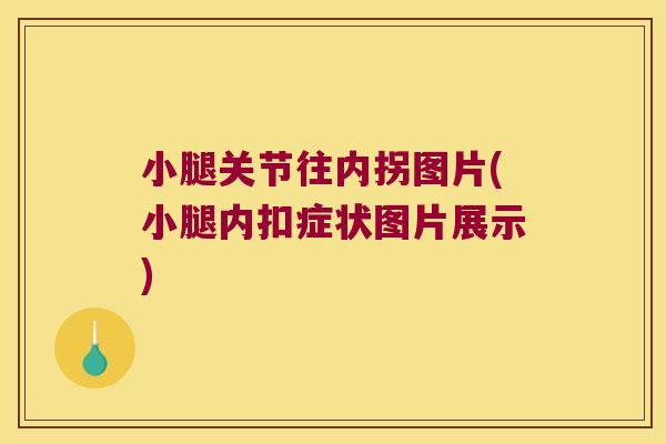 小腿关节往内拐图片(小腿内扣症状图片展示)