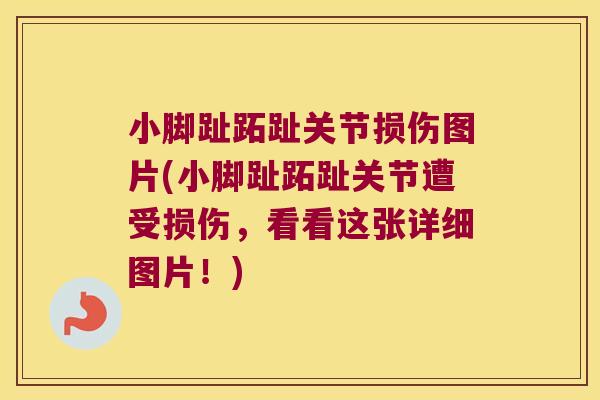 小脚趾跖趾关节损伤图片(小脚趾跖趾关节遭受损伤,看看这张详细图片!)