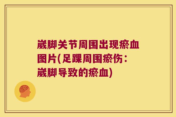 崴脚关节周围出现瘀血图片(足踝周围瘀伤:崴脚导致的瘀血)