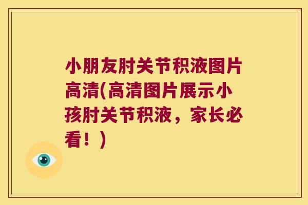 小朋友肘关节积液图片高清(高清图片展示小孩肘关节积液,家长必看!)