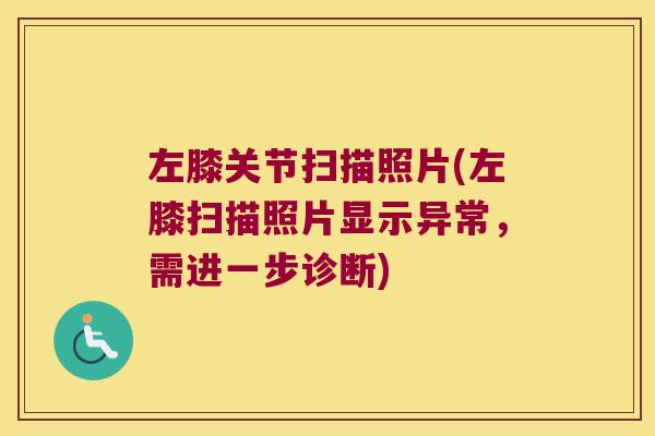 左膝关节扫描照片(左膝扫描照片显示异常,需进一步诊断)