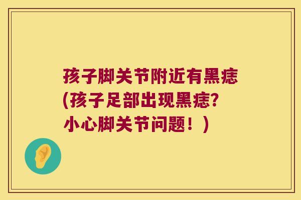 孩子脚关节附近有黑痣(孩子足部出现黑痣?小心脚关节问题!)