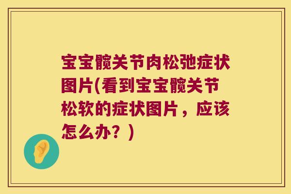 宝宝髋关节肉松弛症状图片(看到宝宝髋关节松软的症状图片,应该怎么办?)