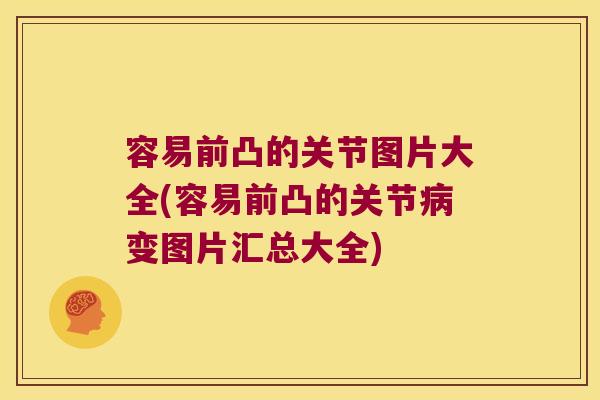 容易前凸的关节图片大全(容易前凸的关节病变图片汇总大全)
