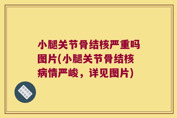 小腿关节骨结核严重吗图片(小腿关节骨结核病情严峻,详见图片)