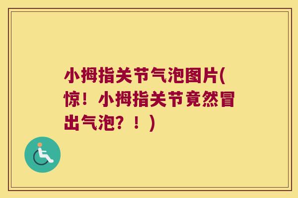 小拇指关节气泡图片(惊!小拇指关节竟然冒出气泡?!) 小拇指关节气泡图片(惊!小拇指关节竟然冒出气泡?!)