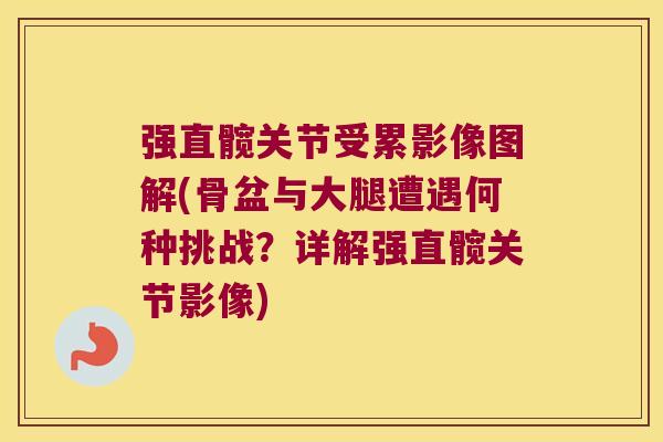 强直髋关节受累影像图解(骨盆与大腿遭遇何种挑战?详解强直髋关节影像)
