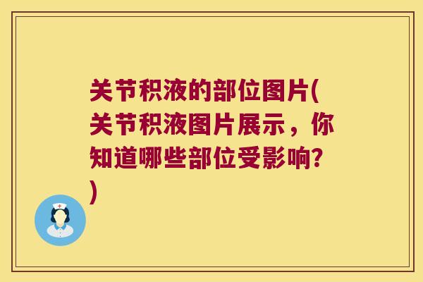 关节积液的部位图片(关节积液图片展示，你知道哪些部位受影响？)
