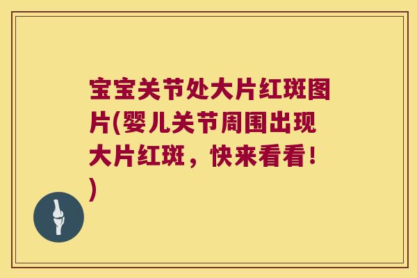 宝宝关节处大片红斑图片(婴儿关节周围出现大片红斑,快来看看!)