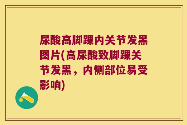 尿酸高脚踝内关节发黑图片(高尿酸致脚踝关节发黑,内侧部位易受影响)