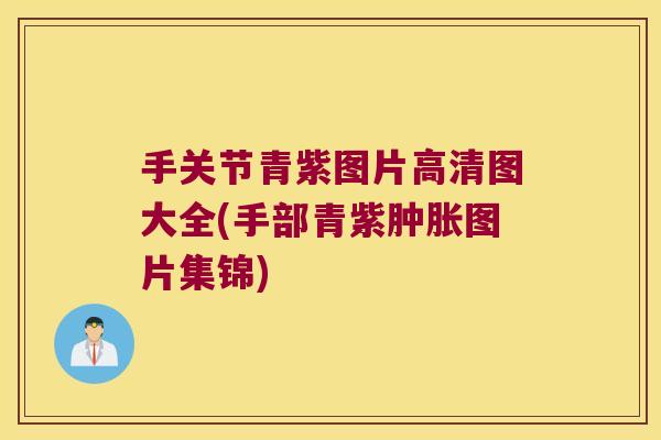 手关节青紫图片高清图大全(手部青紫肿胀图片集锦)