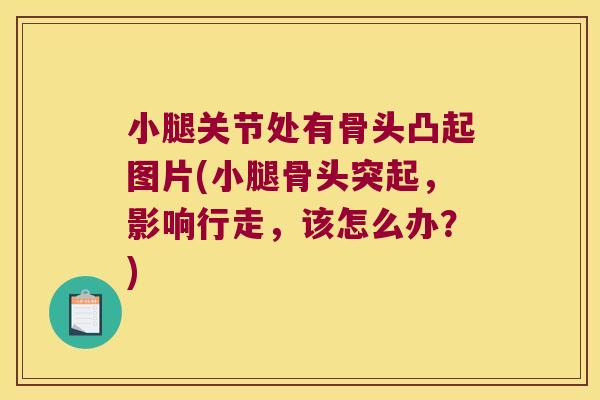 小腿关节处有骨头凸起图片(小腿骨头突起,影响行走,该怎么办?)