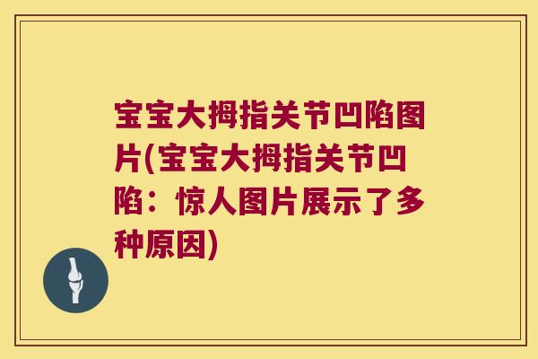 宝宝大拇指关节凹陷图片(宝宝大拇指关节凹陷:惊人图片展示了多种原因)