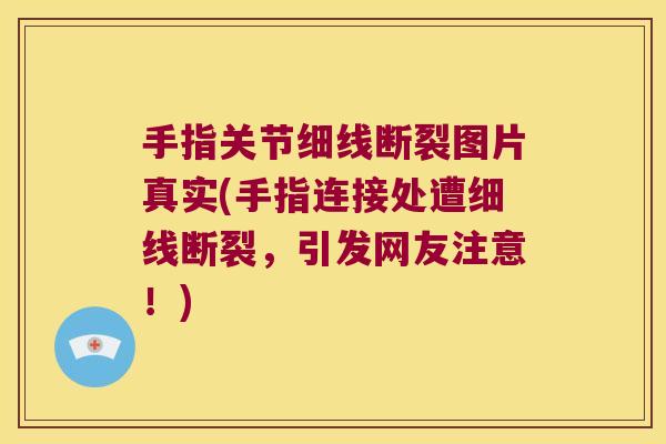 手指关节细线断裂图片真实(手指连接处遭细线断裂,引发网友注意!)