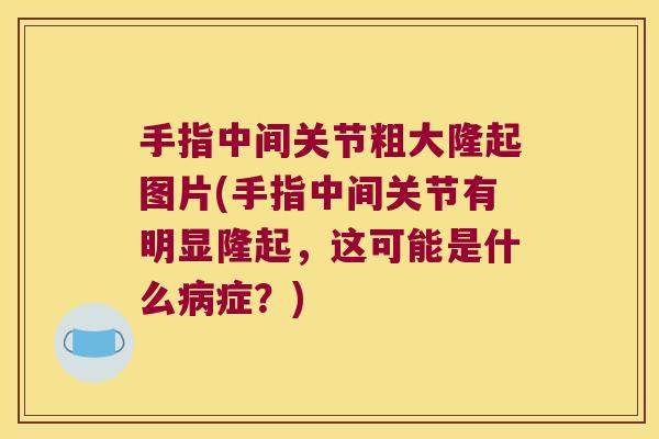 手指中间关节粗大隆起图片(手指中间关节有明显隆起,这可能是什么病症?)