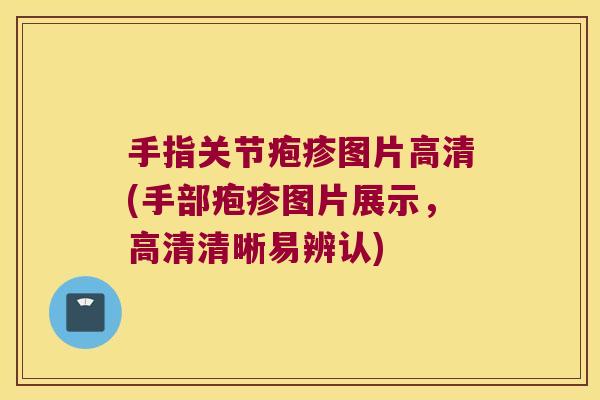 手指关节疱疹图片高清(手部疱疹图片展示,高清清晰易辨认)