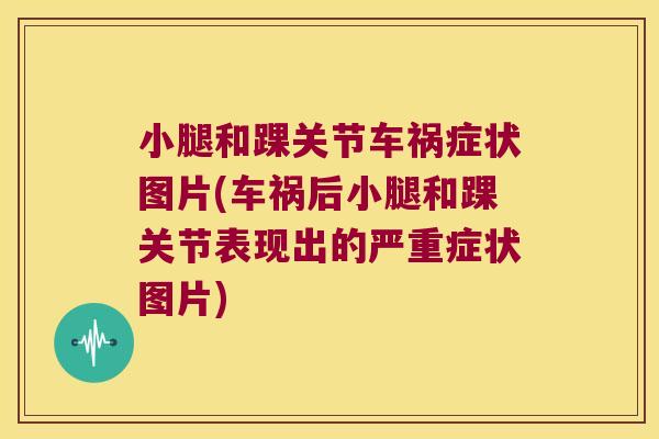 小腿和踝关节车祸症状图片(车祸后小腿和踝关节表现出的严重症状图片)