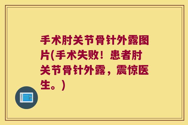 手术肘关节骨针外露图片(手术失败!患者肘关节骨针外露,震惊医生。)