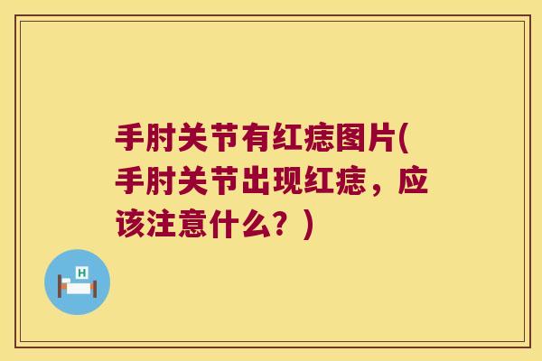 手肘关节有红痣图片(手肘关节出现红痣,应该注意什么?)