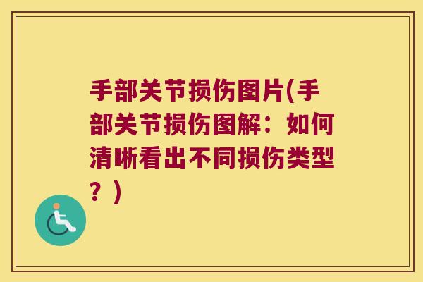 手部关节损伤图片(手部关节损伤图解:如何清晰看出不同损伤类型?)