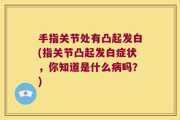 手指关节处有凸起发白(指关节凸起发白症状,你知道是什么病吗?)
