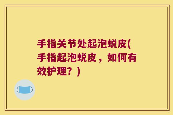 手指关节处起泡蜕皮(手指起泡蜕皮,如何有效护理?)