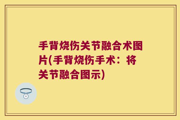 手背烧伤关节融合术图片(手背烧伤手术:将关节融合图示)