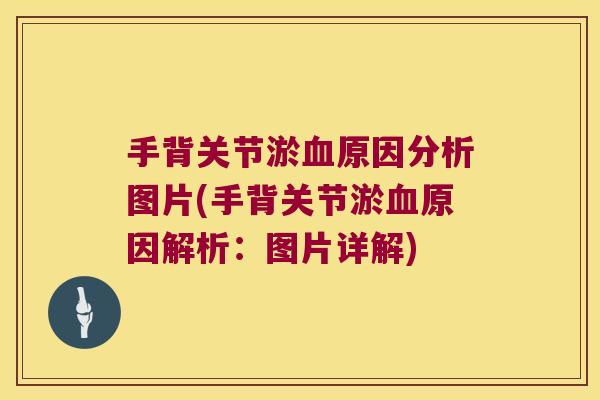 手背关节淤血原因分析图片(手背关节淤血原因解析:图片详解)