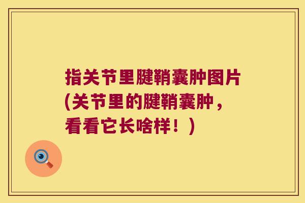 指关节里腱鞘囊肿图片(关节里的腱鞘囊肿,看看它长啥样!)