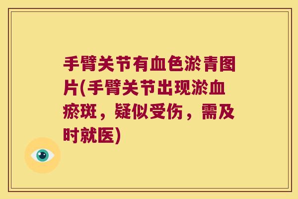手臂关节有血色淤青图片(手臂关节出现淤血瘀斑,疑似受伤,需及时就医)