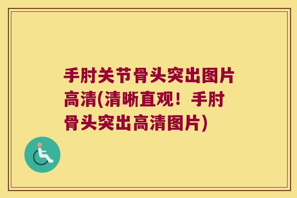 手肘关节骨头突出图片高清(清晰直观!手肘骨头突出高清图片)
