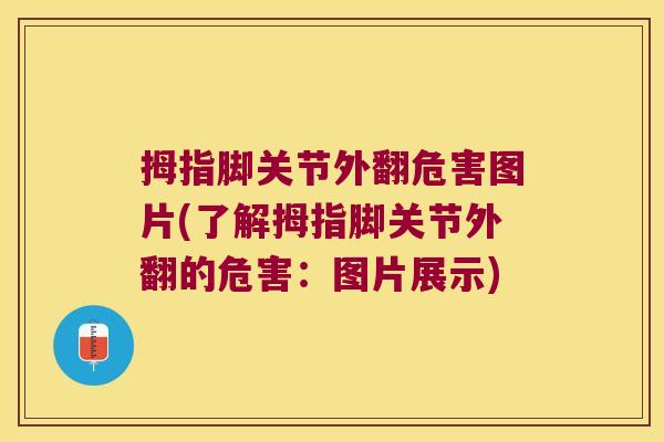 拇指脚关节外翻危害图片(了解拇指脚关节外翻的危害:图片展示) 拇指脚关节外翻危害图片(了解拇指脚关节外翻的危害:图片展示)