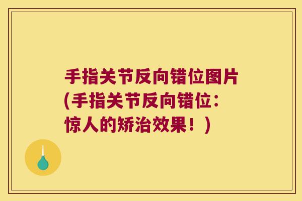 手指关节反向错位图片(手指关节反向错位:惊人的矫治效果!)