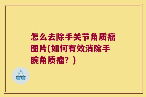 怎么去除手关节角质瘤图片(如何有效消除手腕角质瘤?)
