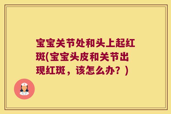 宝宝关节处和头上起红斑(宝宝头皮和关节出现红斑,该怎么办?)