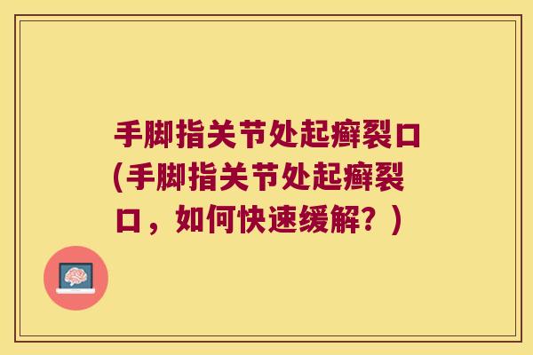 手脚指关节处起癣裂口(手脚指关节处起癣裂口，如何快速缓解？)