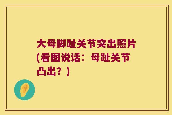 大母脚趾关节突出照片(看图说话:母趾关节凸出?)