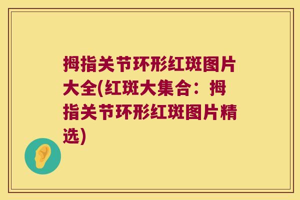 拇指关节环形红斑图片大全(红斑大集合:拇指关节环形红斑图片精选)