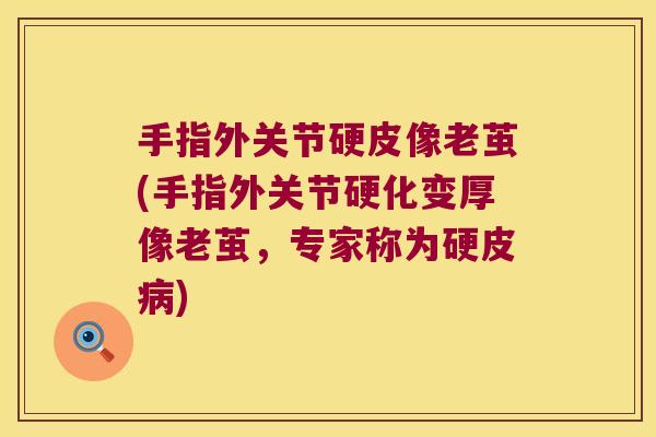 手指外关节硬皮像老茧(手指外关节硬化变厚像老茧,专家称为硬皮病)