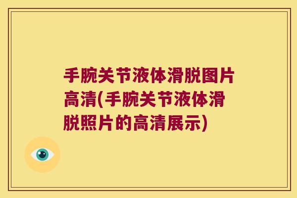 手腕关节液体滑脱图片高清(手腕关节液体滑脱照片的高清展示)