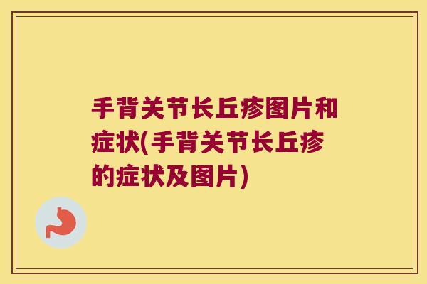 手背关节长丘疹图片和症状(手背关节长丘疹的症状及图片)